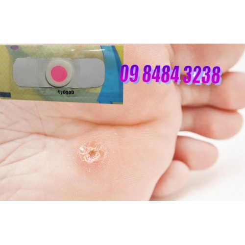 Salicylic acid and phenol plasters miếng dán loại bỏ chai chân, mắt cá chân, mụn cóc ở tay và chân